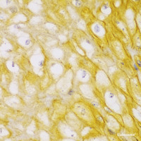 Immunohistochemistry of paraffin-embedded Human esophagus using ACTN1 Polyclonal Antibody at dilution of 1:100 (40x lens) .