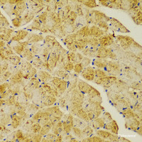 Immunohistochemistry of paraffin-embedded Mouse heart using ACTN1 Polyclonal Antibody at dilution of 1:100 (40x lens) .