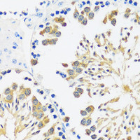 Immunohistochemistry of paraffin-embedded Mouse testis using CALM3 Polyclonal Antibody at dilution of 1:100 (40x lens) .