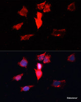 Immunofluorescence analysis of HeLa cells using CALM3 Polyclonal Antibody at dilution of 1:100. Blue: DAPI for nuclear staining.