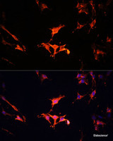 Immunofluorescence analysis of C6 cells using LAMTOR1 Polyclonal Antibody at dilution of 1:100 (40x lens) . Blue: DAPI for nuclear staining.