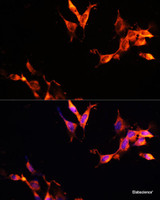 Immunofluorescence analysis of NIH-3T3 cells using LAMTOR1 Polyclonal Antibody at dilution of 1:100 (40x lens) . Blue: DAPI for nuclear staining.