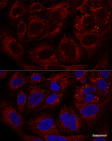 Confocal immunofluorescence analysis of U2OS cells using LAMTOR1 Polyclonal Antibody at dilution of 1:100. Blue: DAPI for nuclear staining.