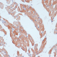 Immunohistochemistry of paraffin-embedded Rat heart using ACSL3 Polyclonal Antibody at dilution of 1:100 (40x lens) .
