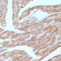 Immunohistochemistry of paraffin-embedded Mouse heart using ACSL3 Polyclonal Antibody at dilution of 1:100 (40x lens) .