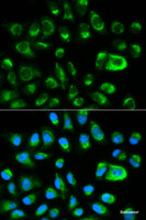 Immunofluorescence analysis of HeLa cells using GAS2 Polyclonal Antibody