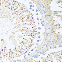 Immunohistochemistry of paraffin-embedded Rat testis using DDX3Y Polyclonal Antibody at dilution of 1:100 (40x lens) .