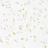 Immunohistochemistry of paraffin-embedded Rat brain using DDX3Y Polyclonal Antibody at dilution of 1:100 (40x lens) .