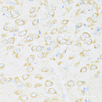 Immunohistochemistry of paraffin-embedded Mouse brain using DDX3Y Polyclonal Antibody at dilution of 1:100 (40x lens) .