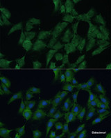 Immunofluorescence analysis of C6 cells using DDX3Y Polyclonal Antibody at dilution of 1:100 (40x lens) . Blue: DAPI for nuclear staining.