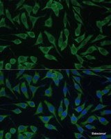 Immunofluorescence analysis of L929 cells using DDX3Y Polyclonal Antibody at dilution of 1:100 (40x lens) . Blue: DAPI for nuclear staining.