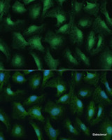 Immunofluorescence analysis of U-2 OS cells using DDX3Y Polyclonal Antibody at dilution of 1:100 (40x lens) . Blue: DAPI for nuclear staining.