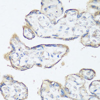 Immunohistochemistry of paraffin-embedded Human placenta using SRC Polyclonal Antibody at dilution of 1:100 (40x lens) .