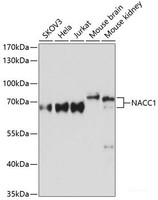 Western blot analysis of extracts of various cell lines using NACC1 Polyclonal Antibody at dilution of 1:3000.