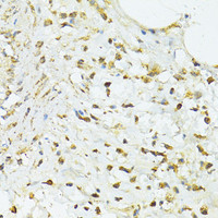 Immunohistochemistry of paraffin-embedded Human vermiform appendix using TRIM15 Polyclonal Antibody at dilution of 1:100 (40x lens) .