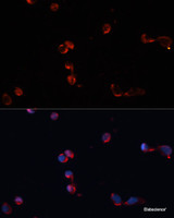 Immunofluorescence analysis of HeLa cells using CAT Polyclonal Antibody at dilution of 1:100. Blue: DAPI for nuclear staining.