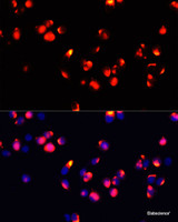 Immunofluorescence analysis of HeLa cells using FXN / FRataxin Polyclonal Antibody at dilution of 1:100 (40x lens) . Blue: DAPI for nuclear staining.