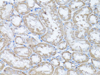 Immunohistochemistry of paraffin-embedded Rat kidney using Snail Polyclonal Antibody at dilution of 1:100 (40x lens) .