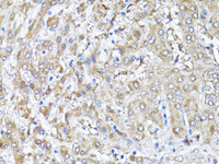 Immunohistochemistry of paraffin-embedded Human liver using Snail Polyclonal Antibody at dilution of 1:100 (40x lens) .