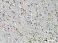 Immunohistochemistry of paraffin-embedded Mouse brain using Snail Polyclonal Antibody at dilution of 1:100 (40x lens) .