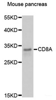 Western blot analysis of extracts of Mouse pancreas using CD8A Polyclonal Antibody at dilution of 1:3000.