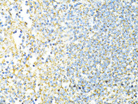 Immunohistochemistry of paraffin-embedded Human tonsil using CD8A Polyclonal Antibody at dilution of 1:100 (40x lens) .