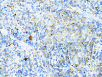 Immunohistochemistry of paraffin-embedded Mouse spleen using CD8A Polyclonal Antibody at dilution of 1:100 (40x lens) .