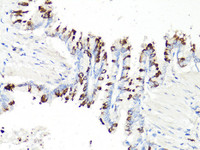 Immunohistochemistry of paraffin-embedded Rat bronchial epithelium using PD-1 Polyclonal Antibody at dilution of 1:100 (40x lens) .
