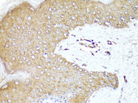 Immunohistochemistry of paraffin-embedded Human skin using PD-1 Polyclonal Antibody at dilution of 1:100 (40x lens) .