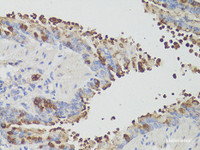 Immunohistochemistry of paraffin-embedded Mouse bronchial epithelium using PD-1 Polyclonal Antibody at dilution of 1:200 (40x lens) .