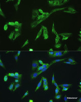 Immunofluorescence analysis of U2OS cells using PD-1 Polyclonal Antibody at dilution of 1:100. Blue: DAPI for nuclear staining.