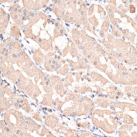 Immunohistochemistry of paraffin-embedded Human stomach using ABCC5 Polyclonal Antibody at dilution of 1:100 (40x lens) .