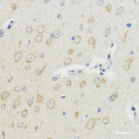 Immunohistochemistry of paraffin-embedded Rat brain using IGF1 Polyclonal Antibody at dilution of 1:100 (40x lens) .