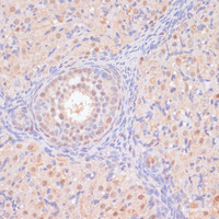 Immunohistochemistry of paraffin-embedded Rat ovary using BYSL Polyclonal Antibody at dilution of 1:100 (40x lens) .
