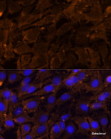 Immunofluorescence analysis of C6 cells using MMP3 Polyclonal Antibody at dilution of 1:100 (40x lens) . Blue: DAPI for nuclear staining.