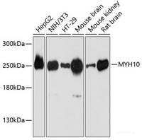 Western blot analysis of extracts of various cell lines using MYH10 Polyclonal Antibody at dilution of 1:3000.