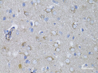 Immunohistochemistry of paraffin-embedded Rat brain using MYH10 Polyclonal Antibody at dilution of 1:100 (40x lens) .
