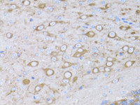 Immunohistochemistry of paraffin-embedded Mouse brain using MYH10 Polyclonal Antibody at dilution of 1:100 (40x lens) .