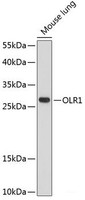Western blot analysis of extracts of Mouse lung using OLR1 Polyclonal Antibody at dilution of 1:1000.