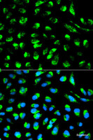 Immunofluorescence analysis of HeLa cells using ECI1 Polyclonal Antibody