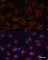 Immunofluorescence analysis of C6 cells using SLC25A24 Polyclonal Antibody at dilution of 1:100. Blue: DAPI for nuclear staining.