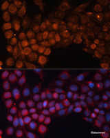 Immunofluorescence analysis of HeLa cells using SLC25A24 Polyclonal Antibody at dilution of 1:100. Blue: DAPI for nuclear staining.