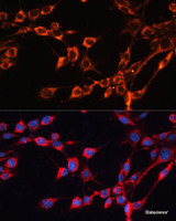 Immunofluorescence analysis of NIH/3T3 cells using SLC25A24 Polyclonal Antibody at dilution of 1:100. Blue: DAPI for nuclear staining.