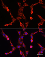 Immunofluorescence analysis of NIH/3T3 cells using ABCD1 Polyclonal Antibody at dilution of 1:100. Blue: DAPI for nuclear staining.