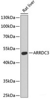 Western blot analysis of extracts of Rat liver using ARRDC3 Polyclonal Antibody at dilution of 1:3000.