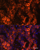 Immunofluorescence analysis of Human liver cancer cells using BHMT Polyclonal Antibody at dilution of 1:100. Blue: DAPI for nuclear staining.
