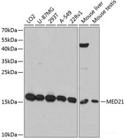 Western blot analysis of extracts of various cell lines using MED21 Polyclonal Antibody at dilution of 1:3000.