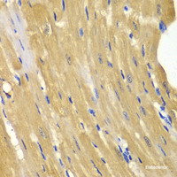 Immunohistochemistry of paraffin-embedded Mouse heart using AK1 Polyclonal Antibody at dilution of 1:100 (40x lens) .