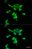 Immunofluorescence analysis of A549 cells using CD55 Polyclonal Antibody