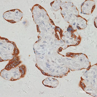 Immunohistochemistry of paraffin-embedded Human placenta using SARS2 Polyclonal Antibody at dilution of 1:100 (40x lens) .